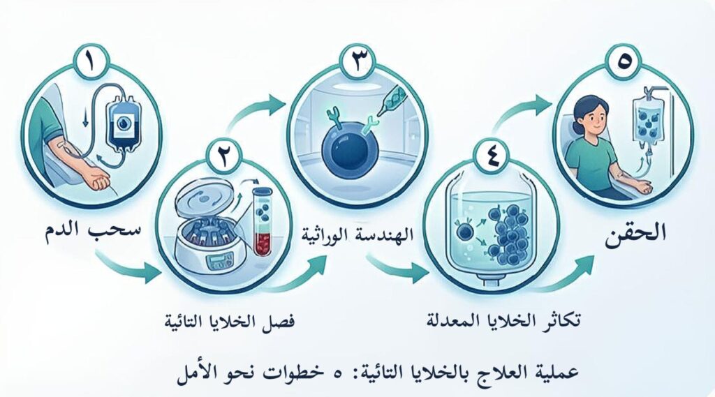 الخطوات الخمس لتقنية علاج الخلايا التائية CAR-T لمحاربة سرطان الدم