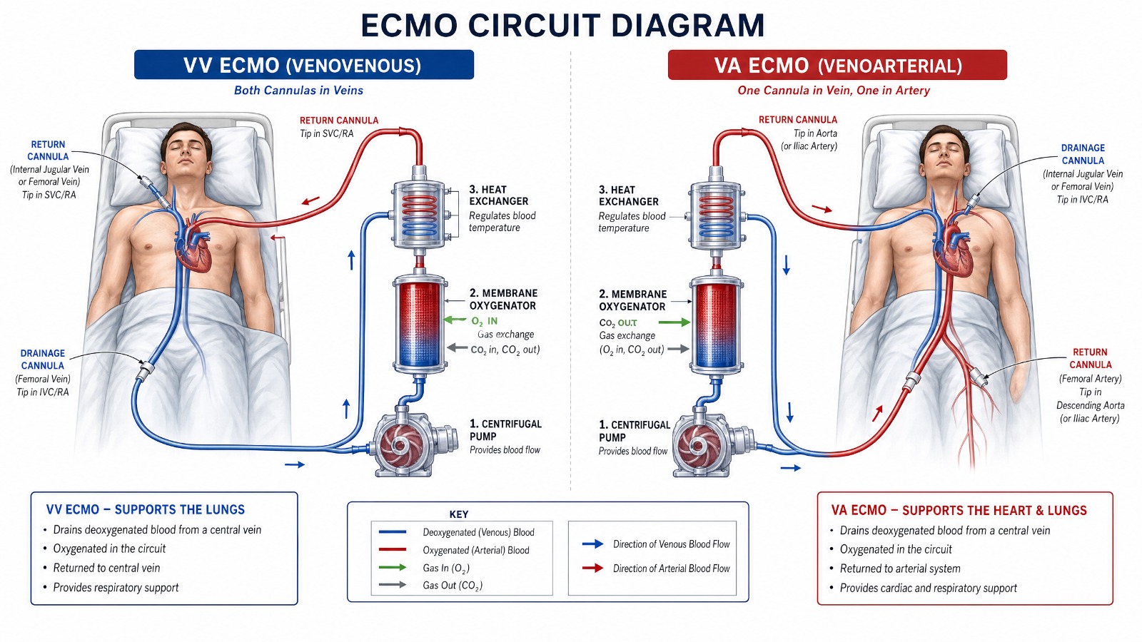 ECMO circuit diagram